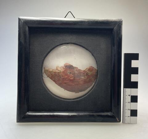 Eisenstaublunge, BMM Charité