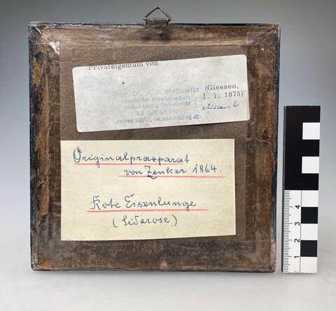 Eisenstaublunge, BMM Charité Rückseite